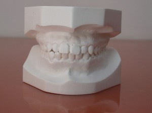 procedure_2
