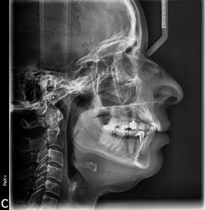 procedure_8