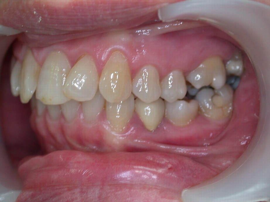 procedure_6